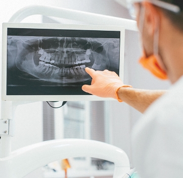 Dental Radiographs (X-Rays)
