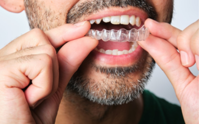 Is Your Retainer Irritating Your Gums? Here’s How to Fix It
