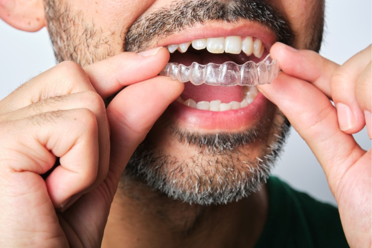 Is Your Retainer Causing Gum Irritation
