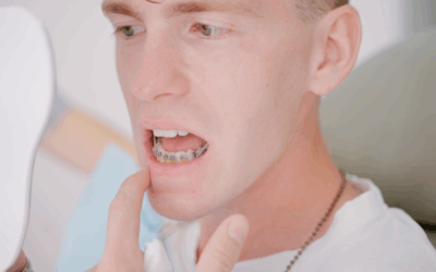 How to Prevent Teeth Grinding with Braces?