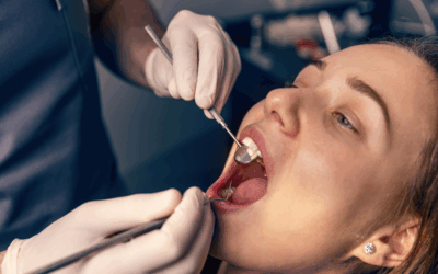 Healing After Tooth Extraction: How Long Does It Really Take?