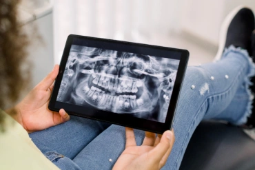 Digital X-Rays