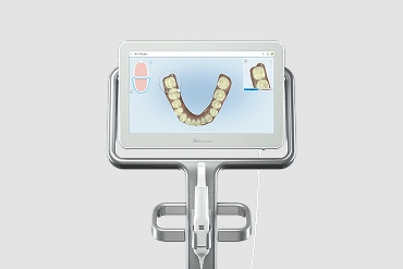 Itero Scanner