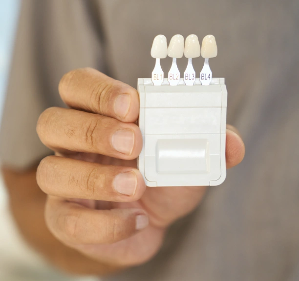 Hand holding a dental veneer model at Adult & Pediatric Dental Studio