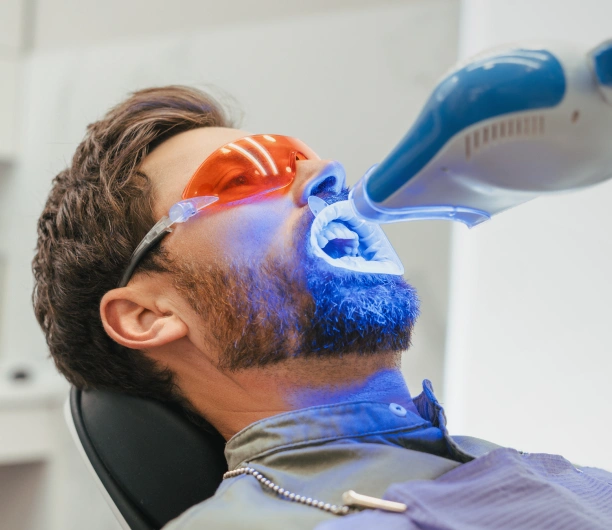 Teeth Whitening