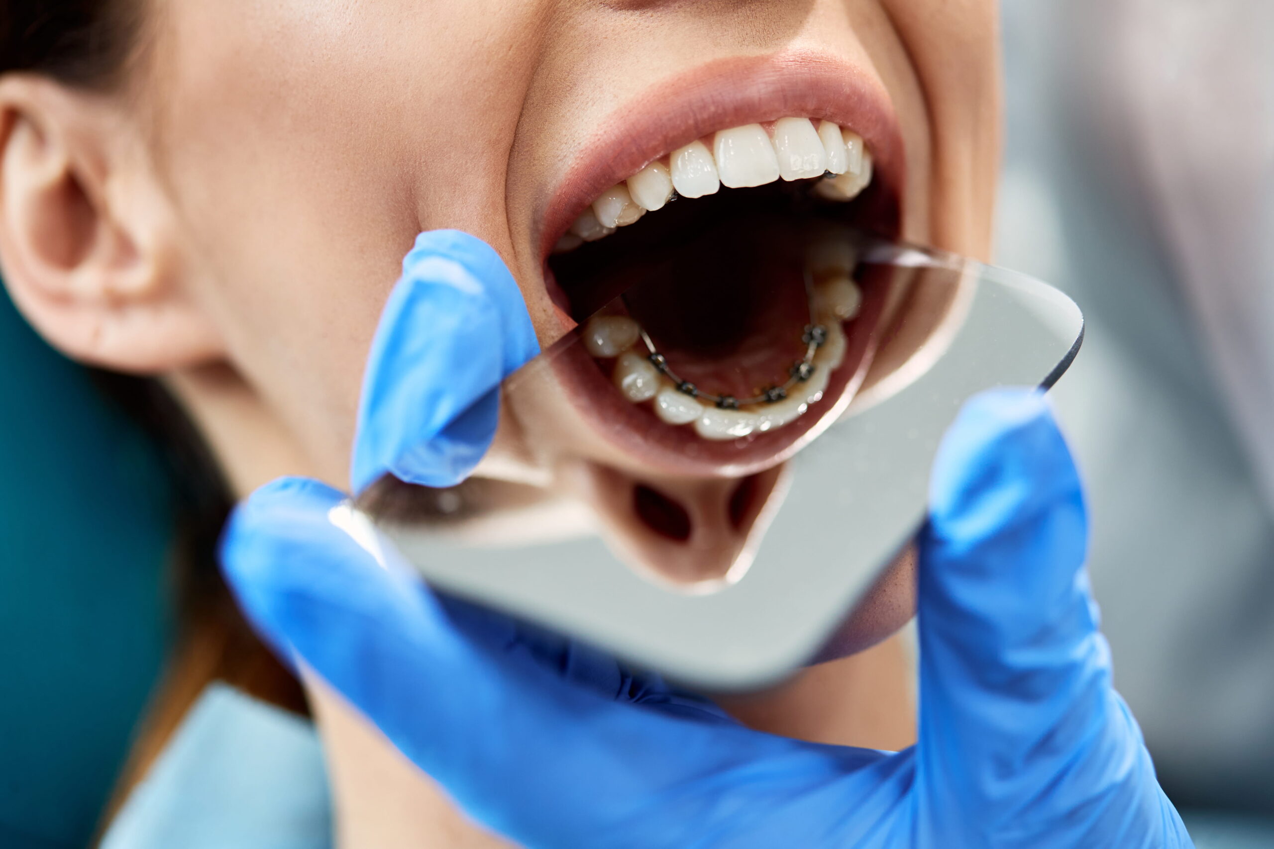 Caring for Braces